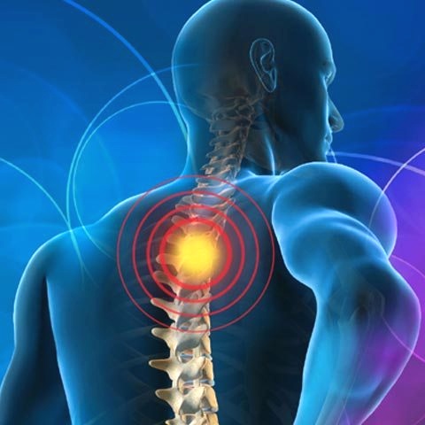 Spondiloza cervicală Simptome cauze și cum se poate trata