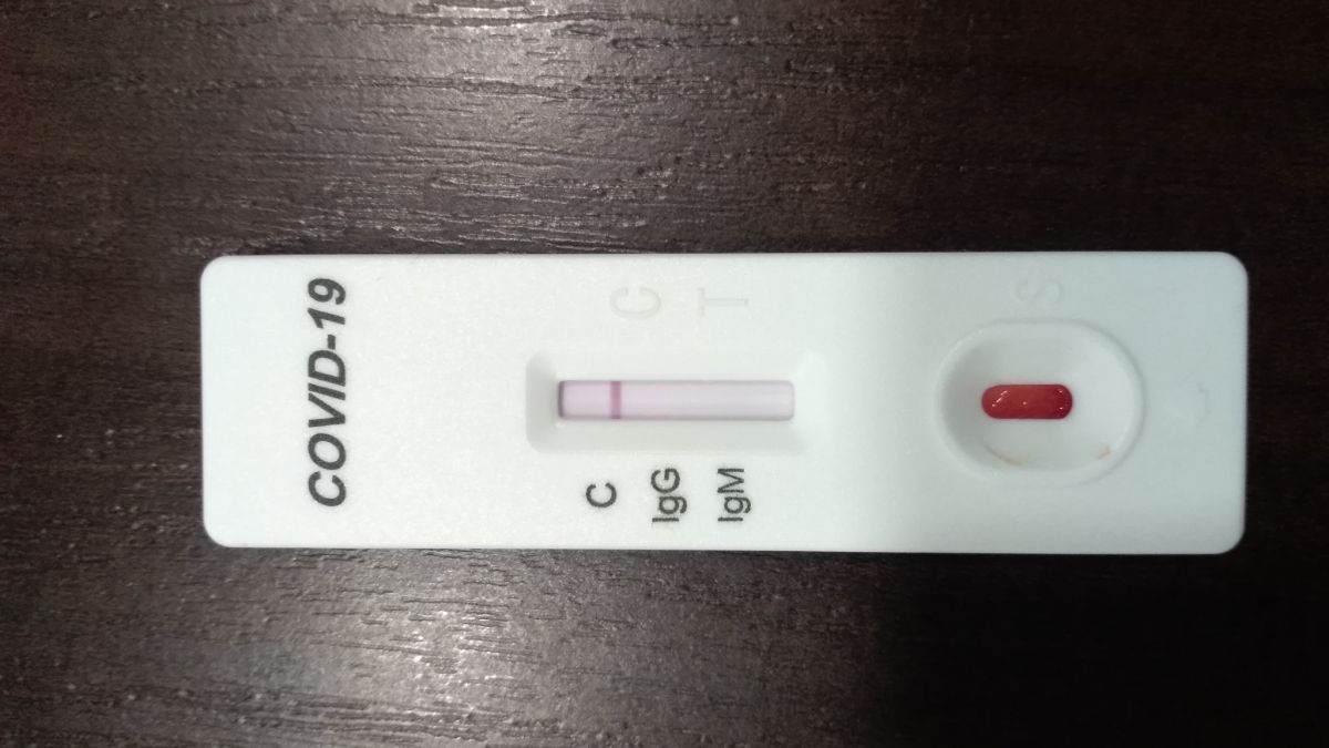 Спи тесте. Тестов на Covid-19 в Молдове. Covid Rapid Test. Девушка сдает экспресс тест. Test Covid Chisinau.