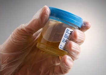 testare corpi cetonici în urină