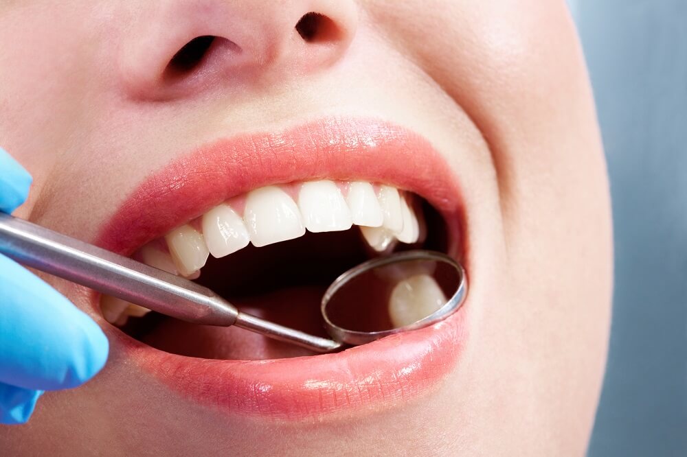 medicul stomatolog verifica starea dintilor unei persoane