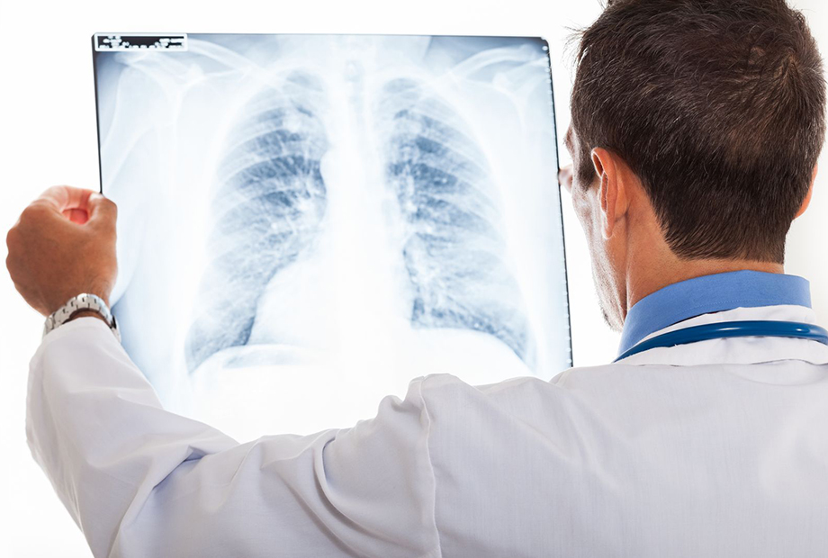grafic medic care analizeaza o radiografie pulmonara