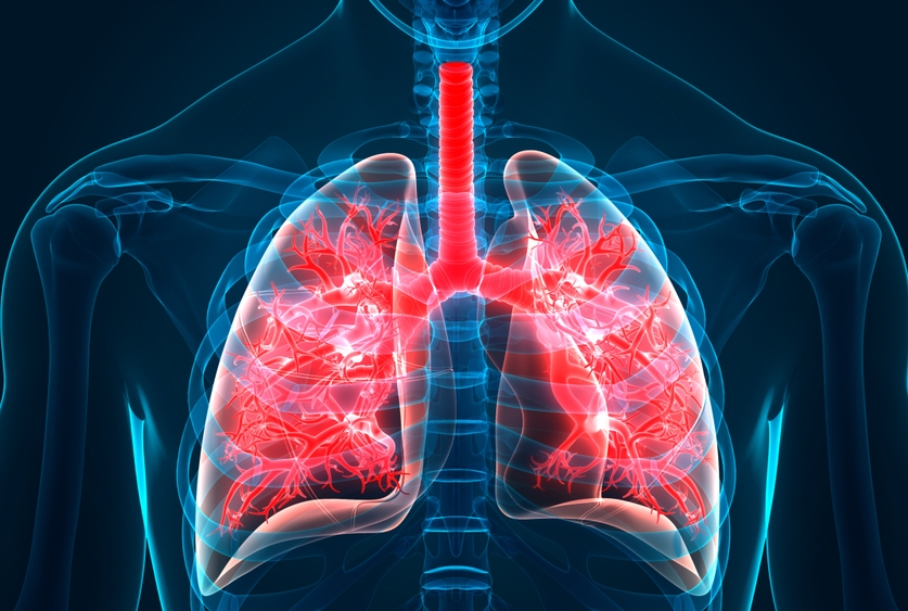 grafica cu plamani ce au fibroza pulmonara