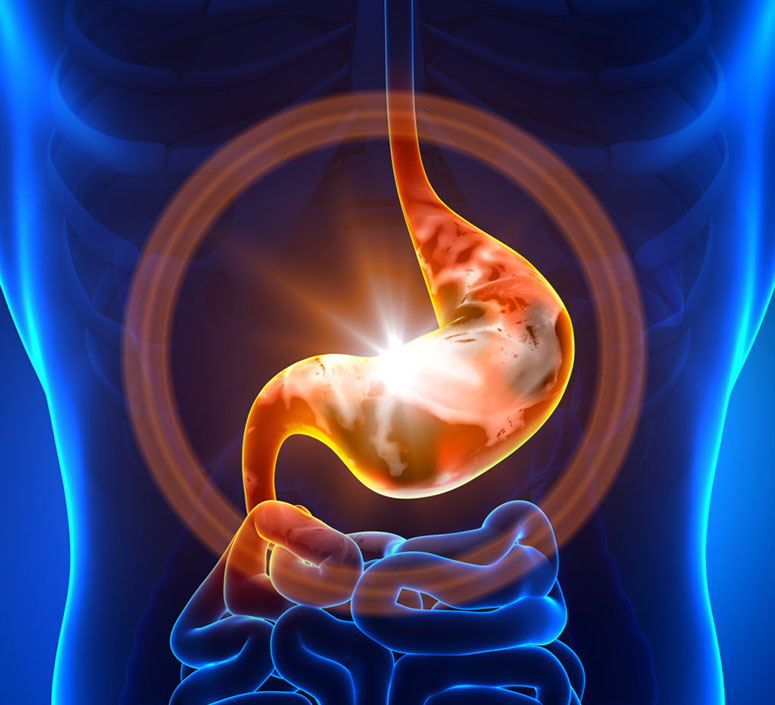 grafica unde se observa un stomac inflamat