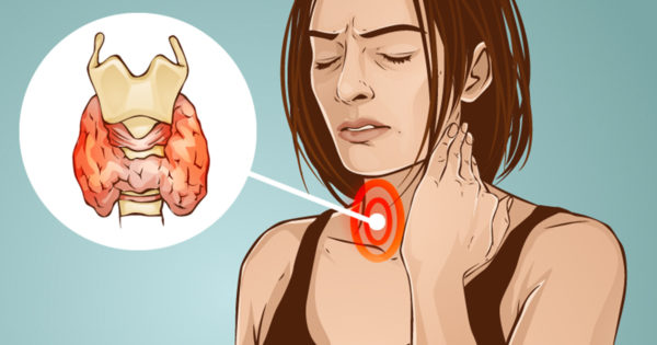 femeie durere ingat glanda tiroida ilustratie