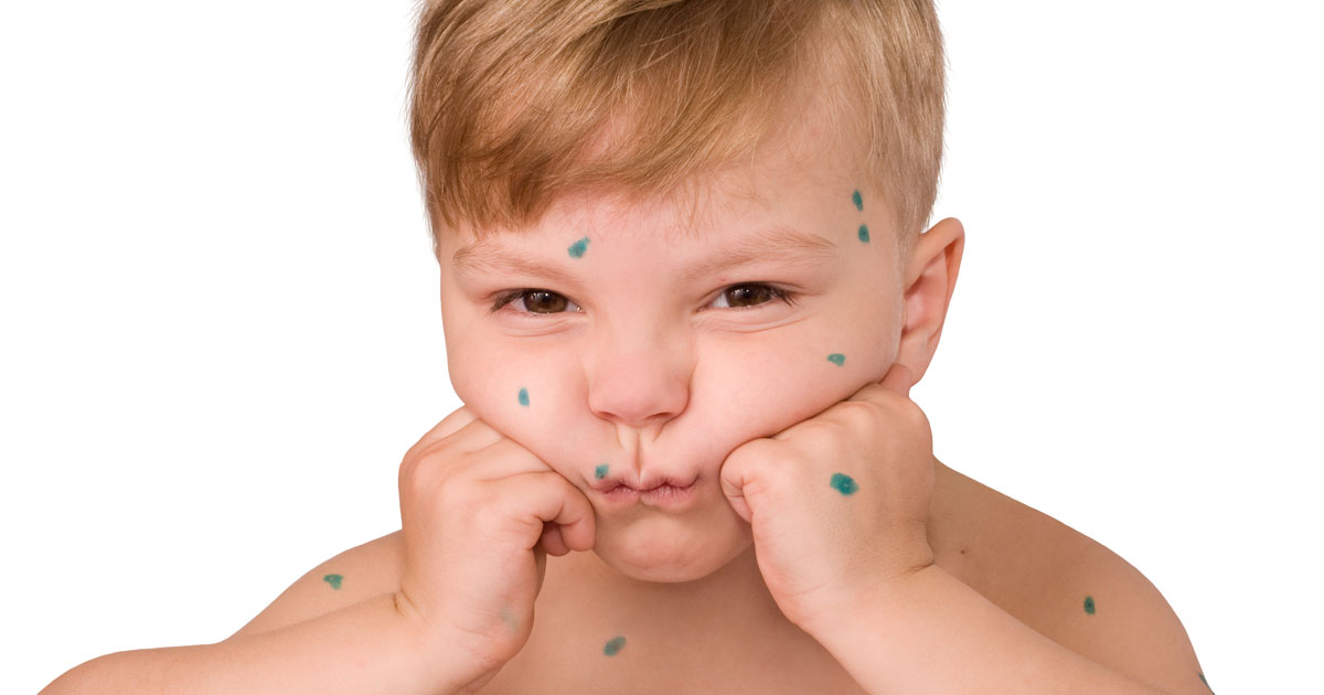 copil care sufera de varicela