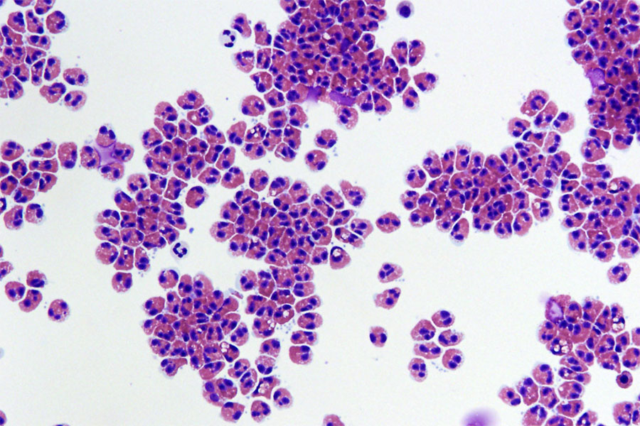 eozinofile la nivel de microscop