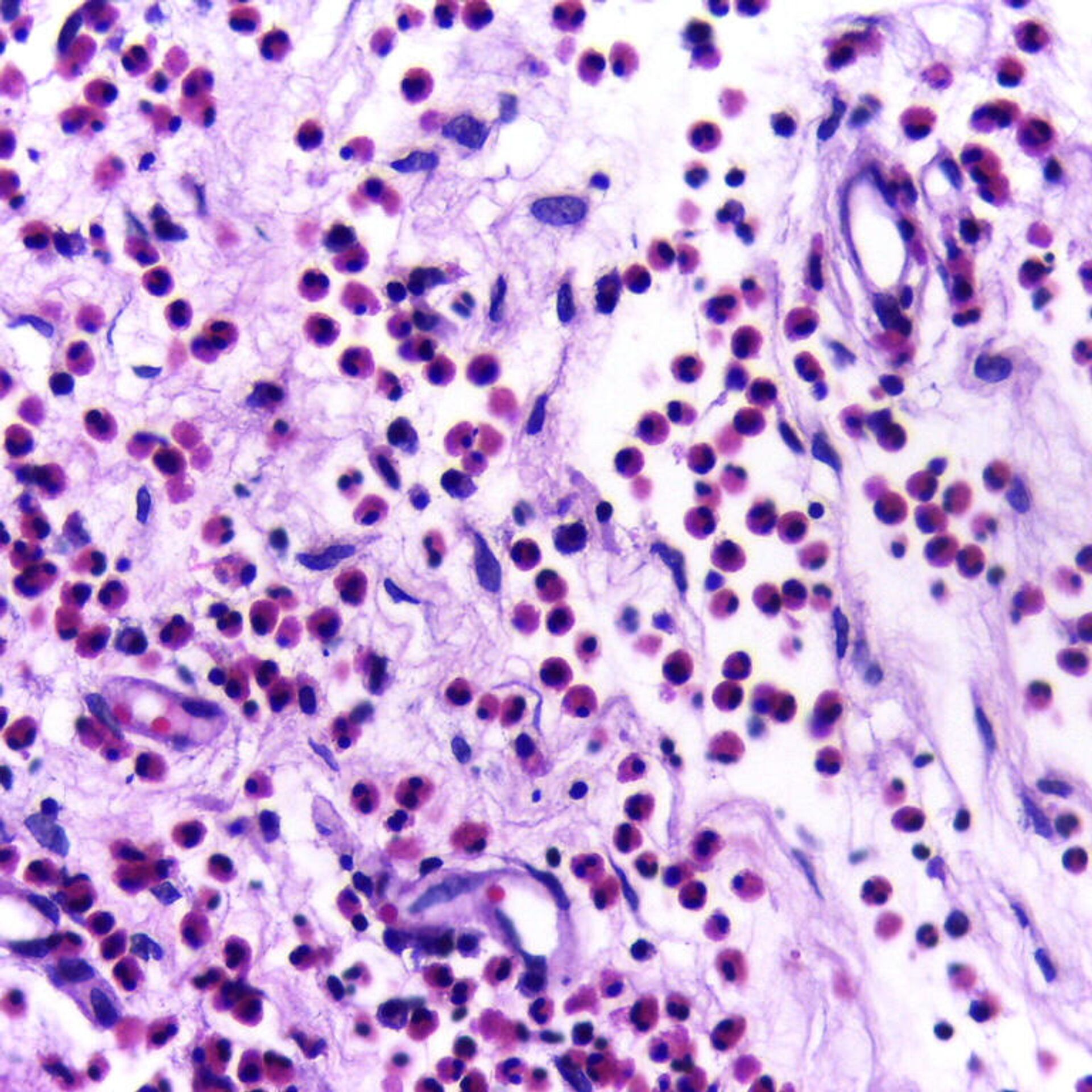 eozinofile la nivel de microscop