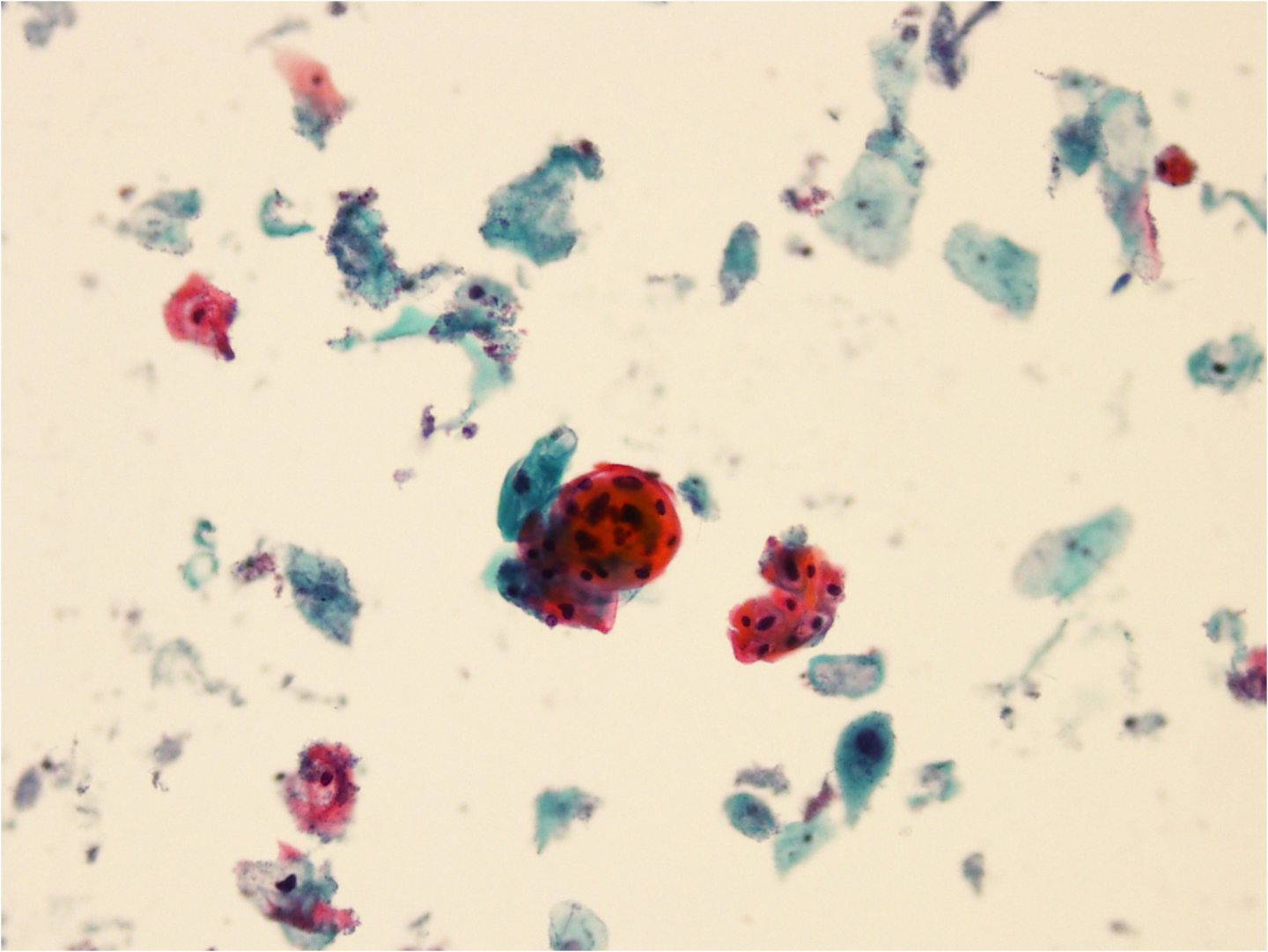 celule epiteliale scuamoase la nivel de microscop