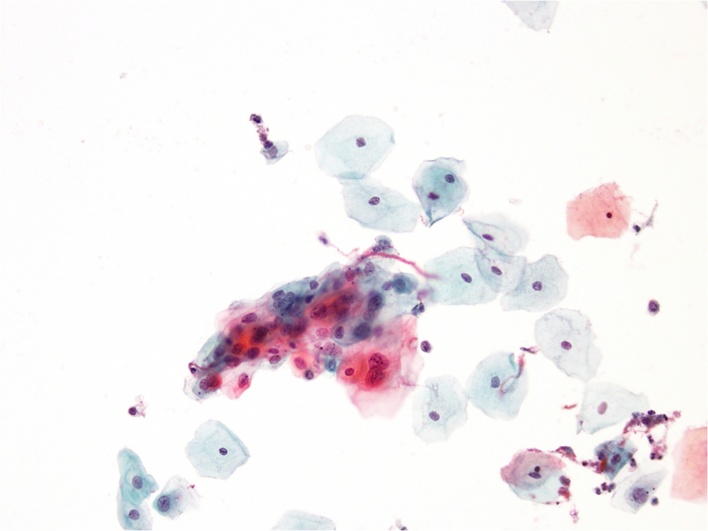 celule epiteliale scuamoase la nivel de microscop