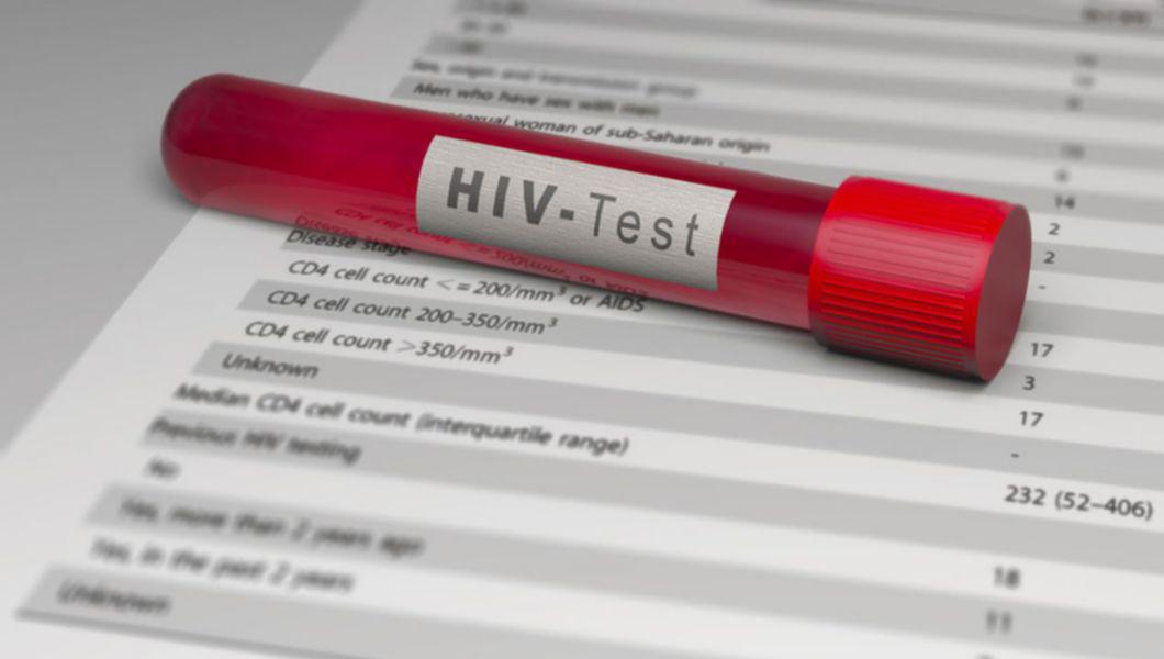 fiola cu HIV Test pe o foaie cu rezultate