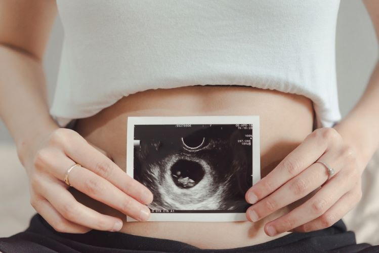 femeie insarcinata care tine in dreptul abdomenului o fotografie de la ultrasunet