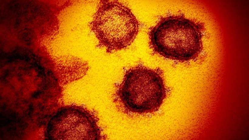 gripa tomatelor vazuta la microscop