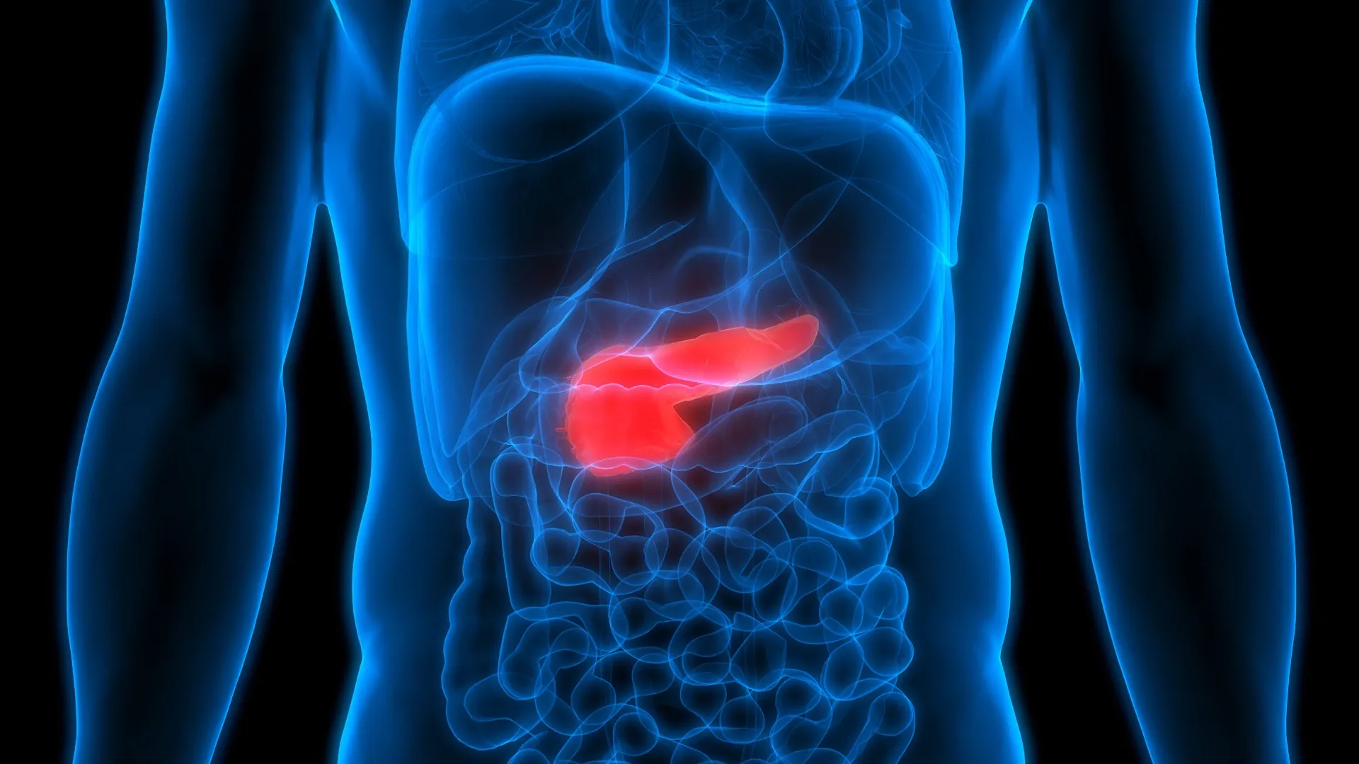 grafica persoana bolnava de cancer pancreatic