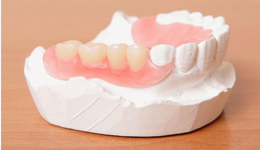 proteza dentara fara cerul gurii pe o masa