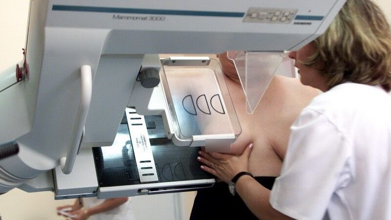 o persoana careia i se face o mamografie