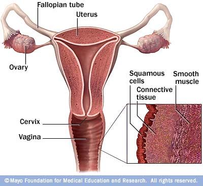 Tot Ce Trebuie Sa Stii Despre Cancerul Ovarian Buna Ziua Iasi Bzi Ro